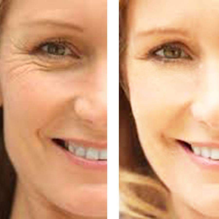 Age Defense : Eye Wrinkle Cream + Vitamin C Serum